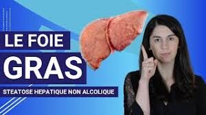 Stéatose hépatique  non alcoolique chez le patient diabétique de type 2  (NAFLD) : Quel bilan en pratique courante ?