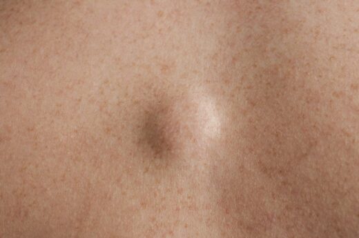 Lipodystrophie et diabète Prévention et prise en charge