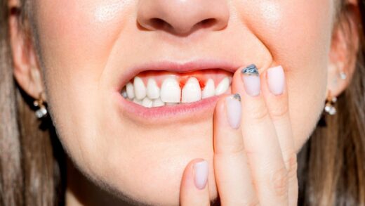 Diabète et Bouche : la parodontopathie, 6ᵉ complication du diabète